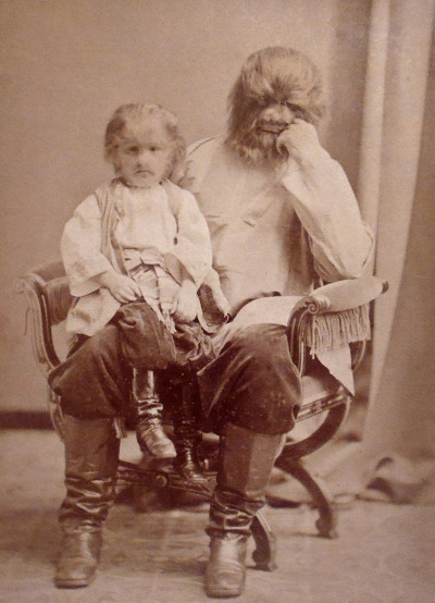  Claude-Antoine Lumière. Adrien Jeftichew with his son Fedor Jeftichew, also known as Jo Jo the Dog Faced Boy. Костромские портреты на Фотографиях зарубежных газет и журналов